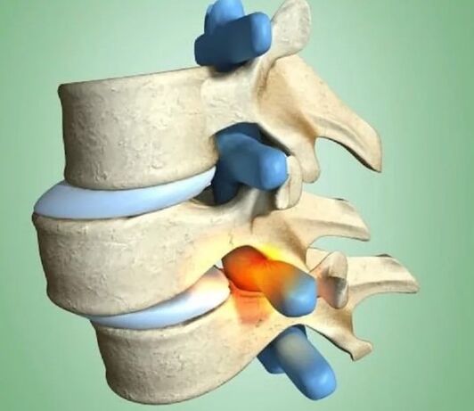 Unstable spine's position