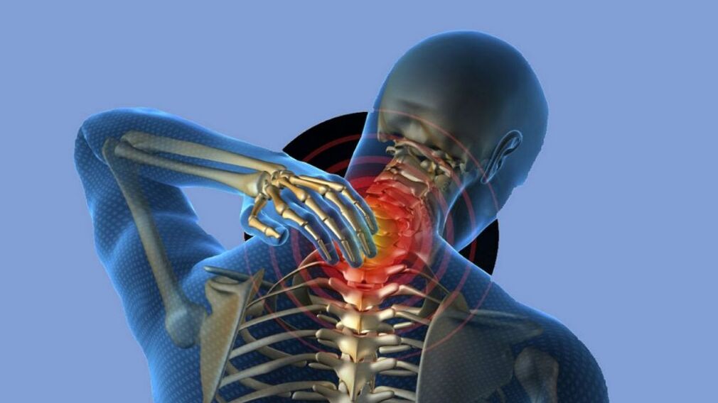 Osteochondrosis of cervical regions