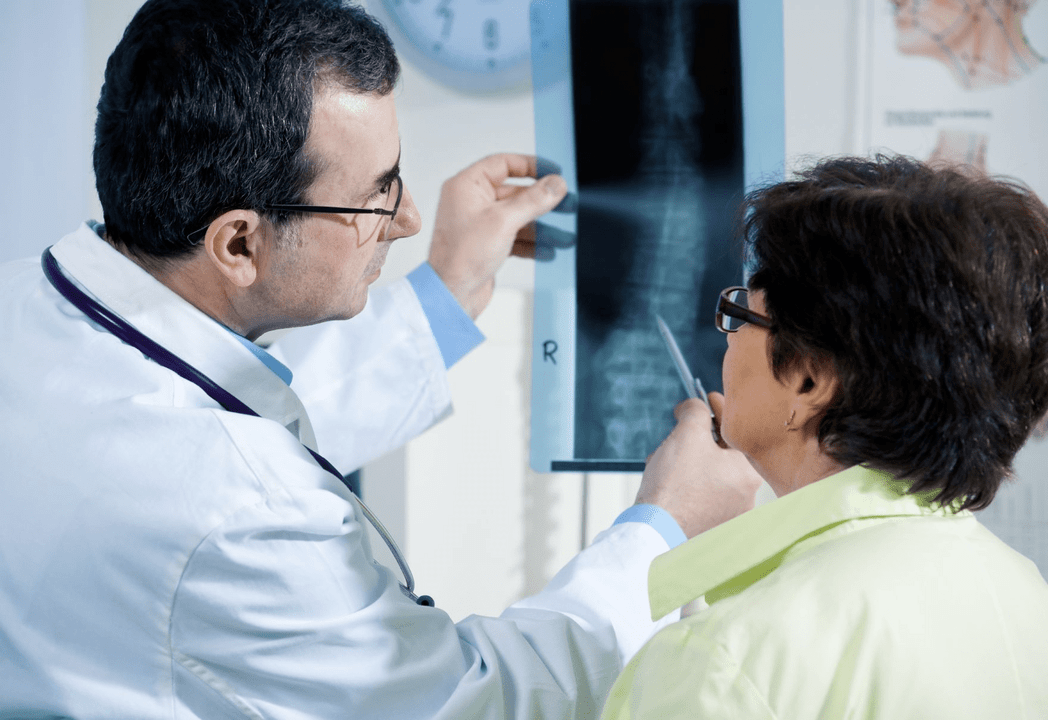 A neurologist diagnoses osteochondrosis using a radiograph of the spine